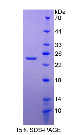 Recombinant Zinc Finger Homeobox Protein 4 (ZFHX4)
