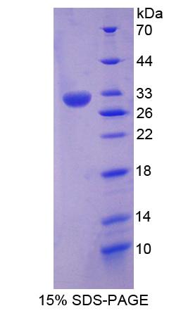 Recombinant Cold Shock Domain Containing Protein E1, RNA Binding (CSDE1)