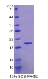 Recombinant RNA Binding Motif Protein 20 (RBM20)