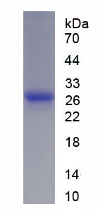 Recombinant Adropin (AD)