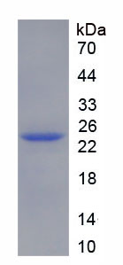 Recombinant Non Metastatic Cells 6, Protein Expressed In (NME6)