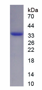 Recombinant Fibronectin Type III Domain Containing Protein 5 (FNDC5)