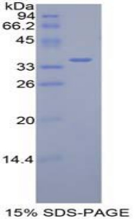 Recombinant Dispatched Homolog 1 (DISP1)