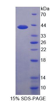 Recombinant Pim-3 Oncogene (PIM3)