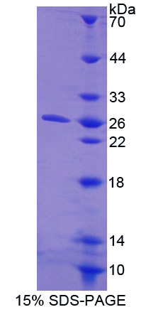Recombinant Collagen Triple Helix Repeat Containing Protein 1 (CTHRC1)