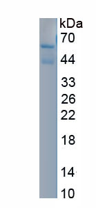 Recombinant Serine/Threonine Kinase 39 (STK39)