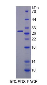 Recombinant Toll Interleukin 1 Receptor Domain Containing Adaptor Protein (TIRAP)