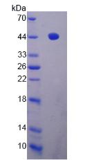 Recombinant A Disintegrin And Metalloproteinase With Thrombospondin 19 (ADAMTS19)