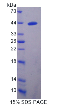 Recombinant A Disintegrin And Metalloproteinase With Thrombospondin 16 (ADAMTS16)
