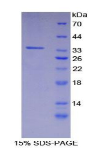 Recombinant Caspase Recruitment Domain Family, Member 9 (CARD9)