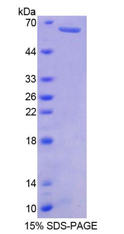 Recombinant Myosin Heavy Chain 7B, Cardiac Muscle Beta (MYH7B)