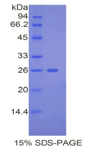 Recombinant A Disintegrin And Metalloproteinase With Thrombospondin 12 (ADAMTS12)