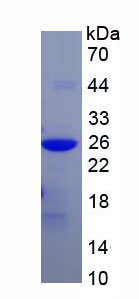 Recombinant Mitochondrial Ribosomal Protein S4 (MRPS4)