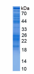 Recombinant Zinc Finger And BTB Domain Containing Protein 20 (ZBTB20)