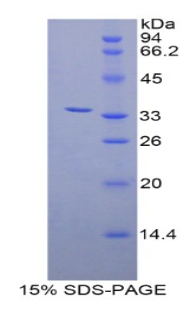 Recombinant Zeta Chain Associated Protein Kinase 70kDa (zAP70)