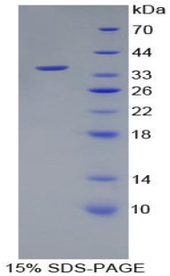 Recombinant Wingless Type MMTV Integration Site Family, Member 10B (WNT10B)