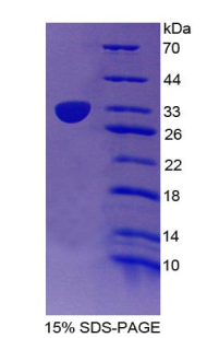 Recombinant T-Box Protein 21 (TBX21)