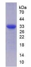 Recombinant Suppression Of Tumorigenicity 14 (ST14)