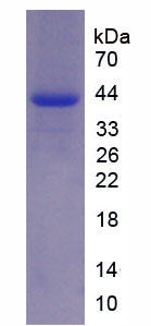 Recombinant Rh Blood Group, D Antigen (RHD)