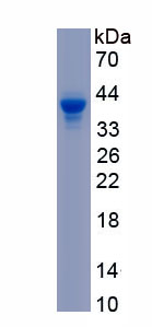 Recombinant RAD51 Homolog (RAD51)