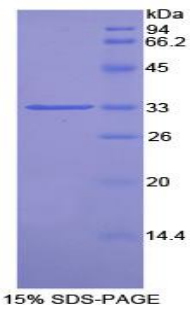 Recombinant Pim-2 Oncogene (PIM2)