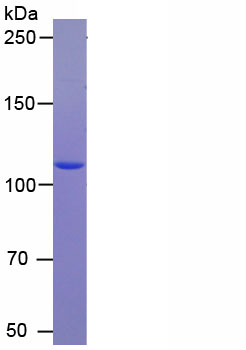 Recombinant Poly ADP Ribose Glycohydrolase (PARG)
