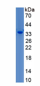 Recombinant Homeobox Protein D12 (HOXD12)