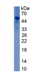 Recombinant Homeobox Protein D11 (HOXD11)