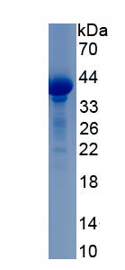 Recombinant Homeobox Protein A11 (HOXA11)