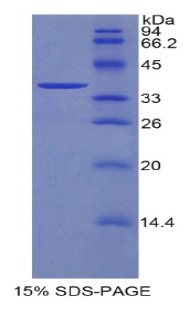 Recombinant Dickkopf Related Protein 4 (DKK4)