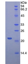 Recombinant Cluster Of Differentiation 8b (CD8b)