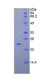 Recombinant Cluster Of Differentiation 8b (CD8b)