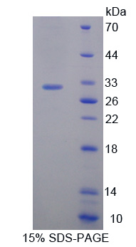 Recombinant BMX Non Receptor Tyrosine Kinase (BMX)
