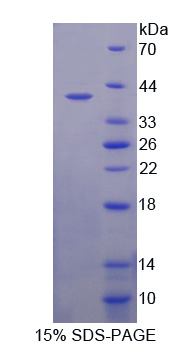 RPQ201Hu01.jpg