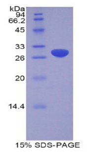 Recombinant A Disintegrin And Metalloprotease 20 (ADAM20)