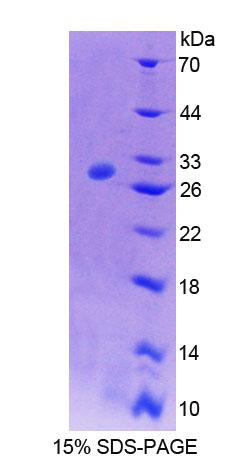 Recombinant ATPase, Na+/K+ Transporting Beta 4 Polypeptide (ATP1b4)