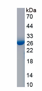 Recombinant Semaphorin 4B (SEMA4B)