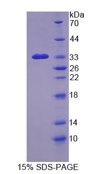 Recombinant Echinoderm Microtubule Associated Protein Like Protein 2 (EML2)