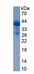 Recombinant Defensin Beta 119 (DEFb119)