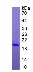 Recombinant Suppressors Of Cytokine Signaling 4 (SOCS4)
