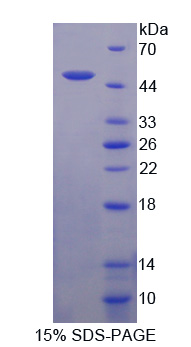 Recombinant Peptidase Inhibitor 16 (PI16)