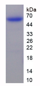 Recombinant Peptidase Inhibitor 16 (PI16)