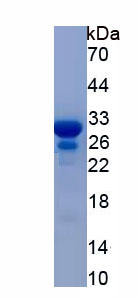 Recombinant Transmembrane Channel Like Protein 5 (TMC5)