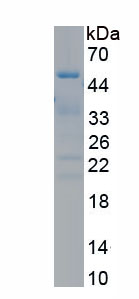 Recombinant Hexokinase Domain Containing Protein 1 (HKDC1)