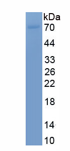 Recombinant Zinc Finger Protein 503 (ZNF503)