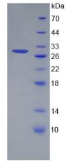 Recombinant Coiled Coil Domain Containing Protein 3 (CCDC3)