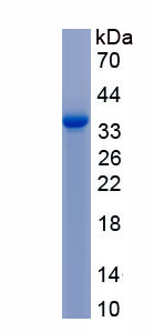 Recombinant Angiopoietin Like Protein 7 (ANGPTL7)