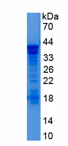 Recombinant RNA Binding Motif Protein, X-Linked 2 (RBMX2)