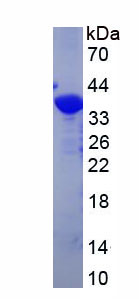 Recombinant YjeF N-Terminal Domain Containing Protein 3 (YJEFN3)