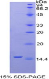 Recombinant Ly1 Antibody Reactive Homolog (LYAR)